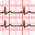 ECG Guide